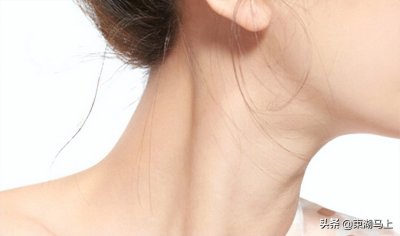 ​颈纹 淡化颈纹的方法原来如此简单