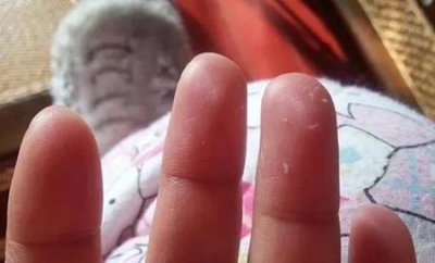 为什么护肤之后脸上会搓泥(脸上用面霜总是吸收不了是什么原因)