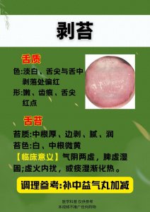 脾胃不好的8种舌象,你都是哪一种?